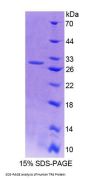 Human Testicular Receptor 4 (TR4) Protein