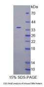 Mouse Estrogen Related Receptor Beta (ERRb) Protein