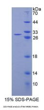 Rat Nuclear Receptor Subfamily 0, Group B, Member 1 (NR0B1) Protein