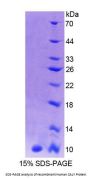 Human Calcyon Neuron Specific Vesicular Protein (CALY) Protein