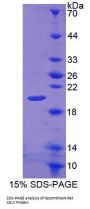 Rat Calcyon Neuron Specific Vesicular Protein (CALY) Protein