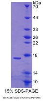 Human Calcium Binding Protein 1 (CABP1) Protein