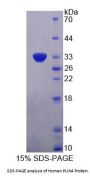 Human Perilipin 4 (PLIN4) Protein