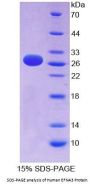 Human Ephrin A3 (EFNA3) Protein