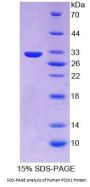 Human Neuroendocrine Convertase 1 (PCSK1) Protein