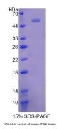 Human Chymotrypsinogen B2 (CTRB2) Protein
