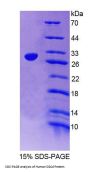 Human Sarcoglycan Delta (SGCd) Protein