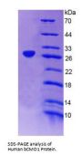 Human Beta-Carotene Oxygenase 1 (BCO1) Protein