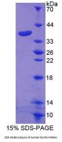 Human Gibbon Ape Leukemia Virus Receptor 1 (GLVR1) Protein