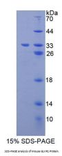 Mouse Gibbon Ape Leukemia Virus Receptor 1 (GLVR1) Protein