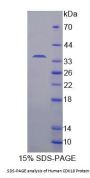 Human Cyclin Dependent Kinase 18 (CDK18) Protein