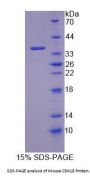 Mouse Cyclin Dependent Kinase 18 (CDK18) Protein