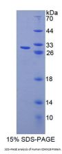 Human Cyclin Dependent Kinase Inhibitor 1B (CDKN1B) Protein