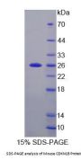 Mouse Cyclin Dependent Kinase Inhibitor 1B (CDKN1B) Protein