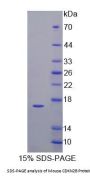 Mouse Cyclin Dependent Kinase Inhibitor 2B (CDKN2B) Protein