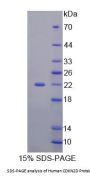 Human Cyclin Dependent Kinase Inhibitor 2D (CDKN2D) Protein
