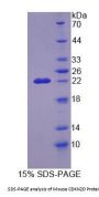 Mouse Cyclin Dependent Kinase Inhibitor 2D (CDKN2D) Protein