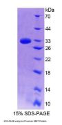 Human Guanylate Binding Protein 7 (GBP7) Protein