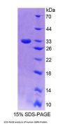 Human Guanylate Binding Protein 6 (GBP6) Protein