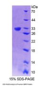 Human Guanylate Binding Protein 5 (GBP5) Protein