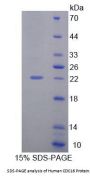 Human Cell Division Cycle Protein 16 (CDC16) Protein