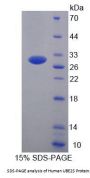 Human Ubiquitin Conjugating Enzyme E2S (UBE2S) Protein