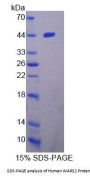Human Tryptophanyl tRNA Synthetase 2, Mitochondrial (WARS2) Protein