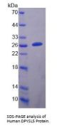 Human Dihydropyrimidinase Like Protein 5 (DPYSL5) Protein