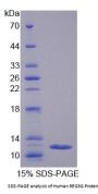 Human Islet Derived Protein 3 Gamma (REG3g) Protein