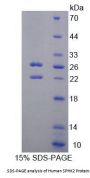 Human Sphingosine Kinase 2 (SPHK2) Protein