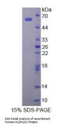 Human Retinal Dehydrogenase 1 (ALDH1A1) Protein