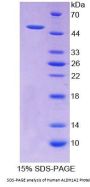 Human Aldehyde Dehydrogenase 1 Family, Member A2 (ALDH1A2) Protein