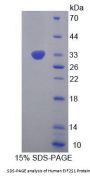 Human Eukaryotic Translation Initiation Factor 2 Subunit 1 (EIF2S1) Protein