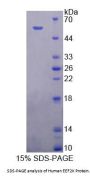 Human Eukaryotic Elongation Factor 2 Kinase (EEF2K) Protein