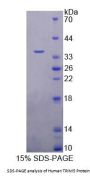 Human Tripartite Motif Containing Protein 5 (TRIM5) Protein