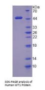 Human Wilms Tumor 1 (WT1) Protein