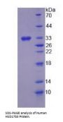 Human 17-Beta-Hydroxysteroid Dehydrogenase Type 3 (HSD17b3) Protein