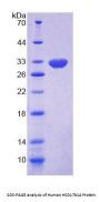 Human 17-Beta-Hydroxysteroid Dehydrogenase Type 14 (HSD17B14) Protein