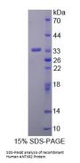 Human Anthrax Toxin Receptor 2 (ANTXR2) Protein