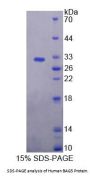 Human BAG Family Molecular Chaperone Regulator 5 (BAG5) Protein