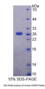 Human Calcium Homeostasis Endoplasmic Reticulum Protein (CHERP) Protein