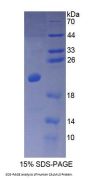 Human Calmodulin Like Protein 3 (CALML3) Protein