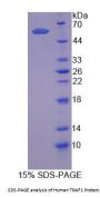 Human TNF Receptor Associated Factor 1 (TRAF1) Protein