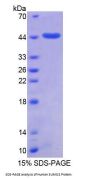 Human Small Ubiquitin Related Modifier Protein 2 (SUMO2) Protein