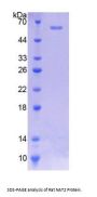 Rat N-Acetyltransferase 2 (NAT2) Protein