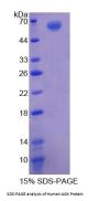 Human Acylglycerol Kinase (AGK) Protein