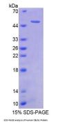 Human Cerebellin 1 (CBLN1) Protein