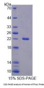 Human Sodium/Potassium-Transporting ATPase Subunit Alpha 1 (ATP1A1) Protein