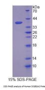Human Secretoglobin Family 2A, Member 2 (SCGB2A2) Protein