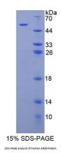 Human Arylsulfatase B (ARSB) Protein